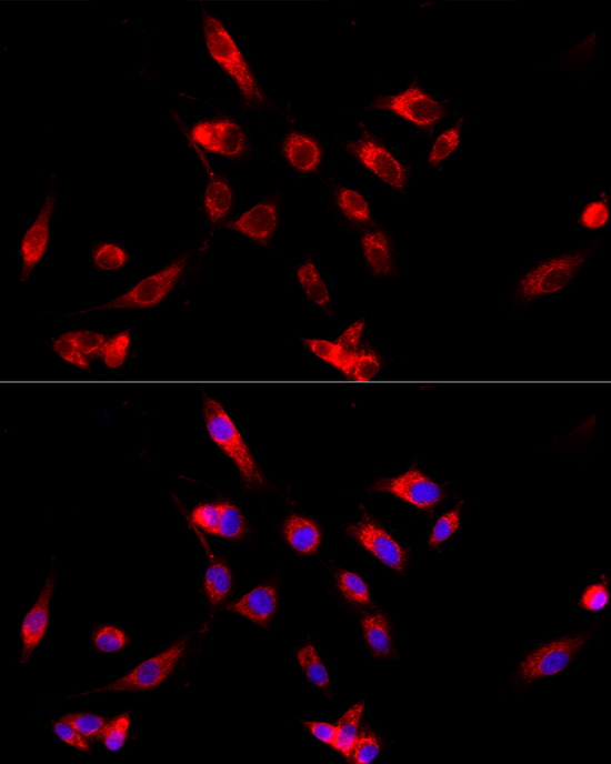 CYP4V2 Rabbit polyclonal antibody