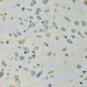 DARS Rabbit polyclonal antibody