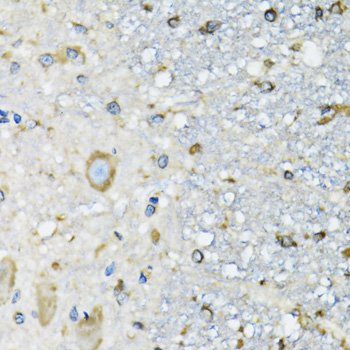 DARS Rabbit polyclonal antibody