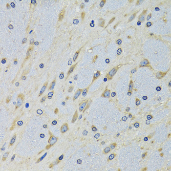 DARS Rabbit polyclonal antibody