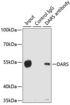 DARS Rabbit polyclonal antibody