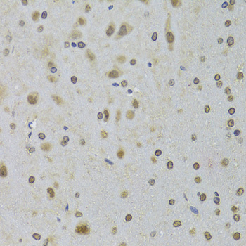 DDX1 Rabbit polyclonal antibody