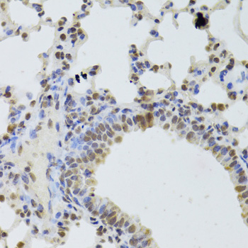 DDX1 Rabbit polyclonal antibody