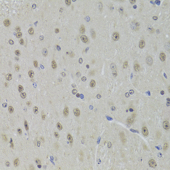 DDX1 Rabbit polyclonal antibody