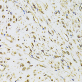 DDX1 Rabbit polyclonal antibody
