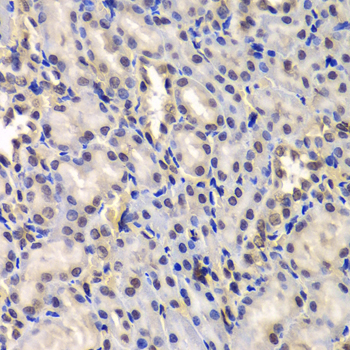 DDX41 Rabbit polyclonal antibody