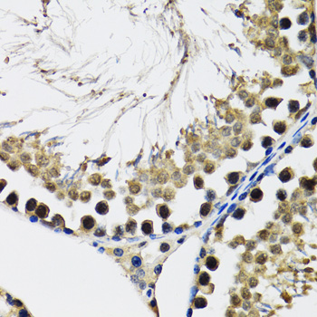 DDX41 Rabbit polyclonal antibody
