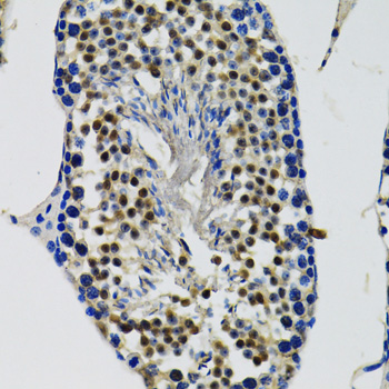 DDX41 Rabbit polyclonal antibody