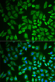 DDX41 Rabbit polyclonal antibody