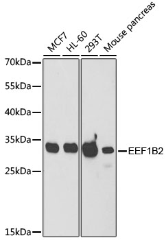 [KO Validated] EEF1B2 Rabbit polyclonal antibody