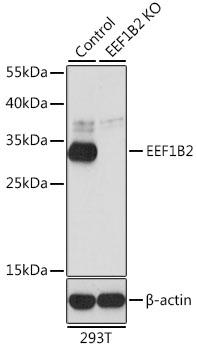 [KO Validated] EEF1B2 Rabbit polyclonal antibody
