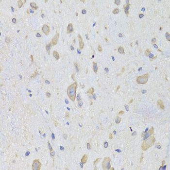 [KO Validated] EEF1B2 Rabbit polyclonal antibody