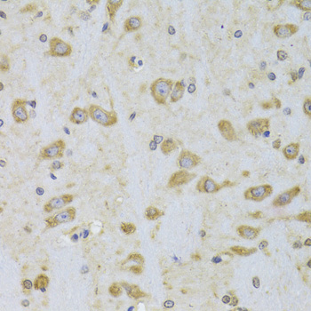 [KO Validated] EEF1B2 Rabbit polyclonal antibody