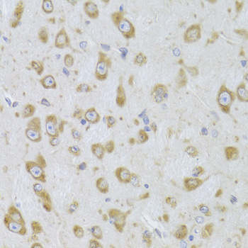 [KO Validated] EEF1B2 Rabbit polyclonal antibody