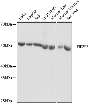 EIF2S3 Rabbit polyclonal antibody