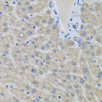 EIF2S3 Rabbit polyclonal antibody