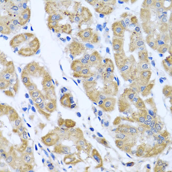 EIF2S3 Rabbit polyclonal antibody