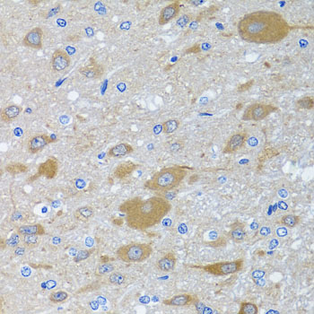 EIF2S3 Rabbit polyclonal antibody