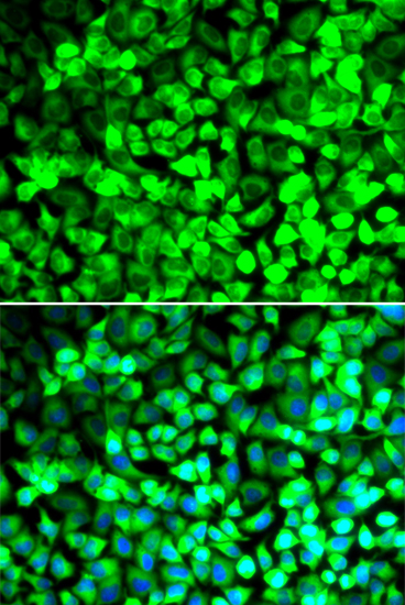 EIF5 Rabbit polyclonal antibody