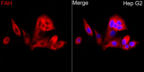 FAH Rabbit polyclonal antibody