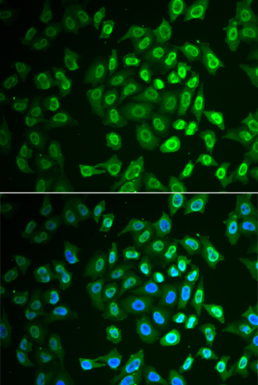 FAH Rabbit polyclonal antibody