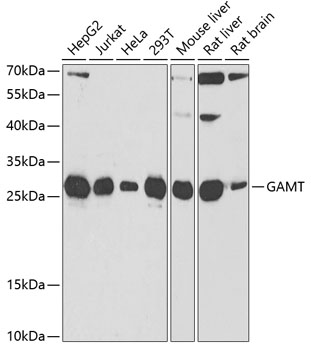 GAMT Rabbit polyclonal antibody