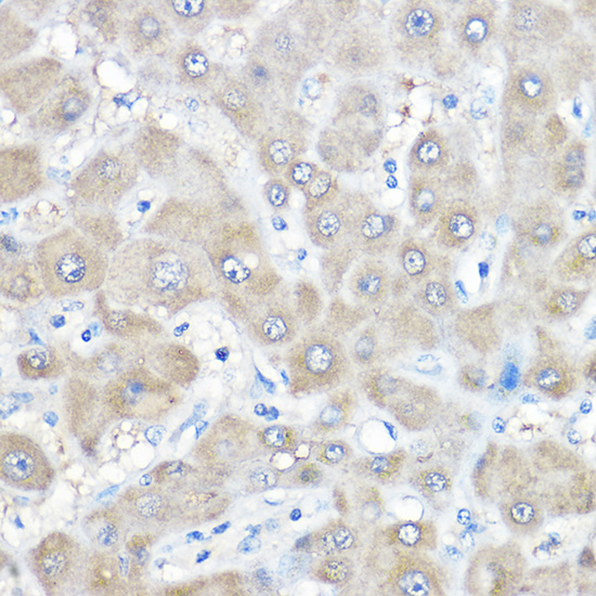 GAMT Rabbit polyclonal antibody