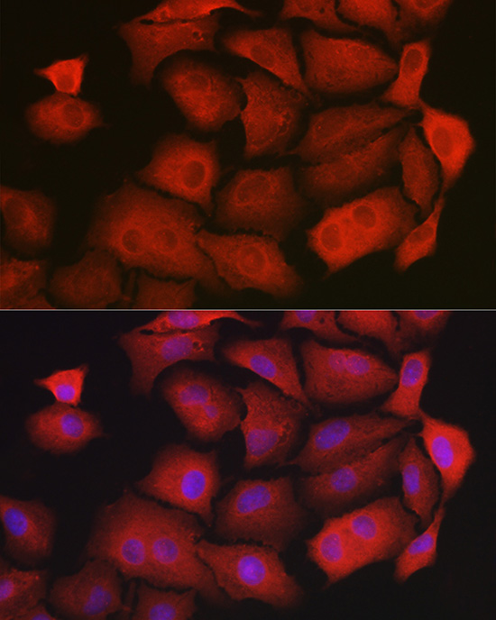 GAMT Rabbit polyclonal antibody