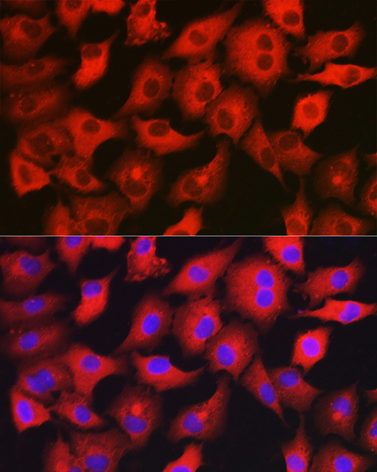 GAMT Rabbit polyclonal antibody