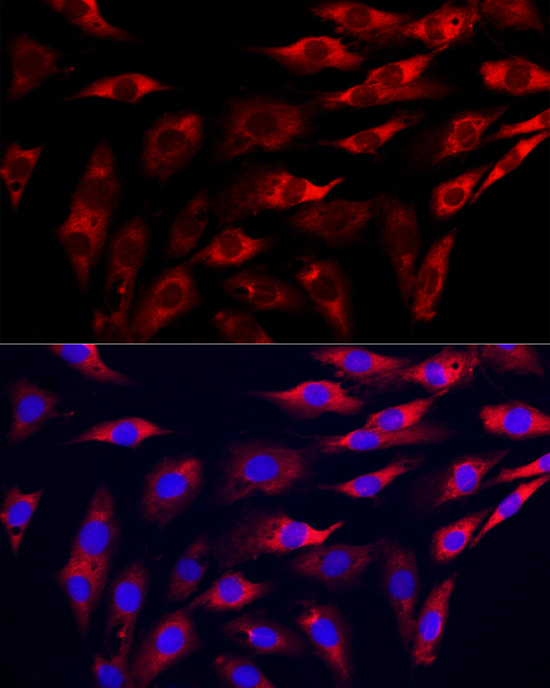 GAMT Rabbit polyclonal antibody