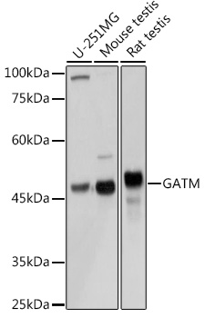GATM Rabbit polyclonal antibody