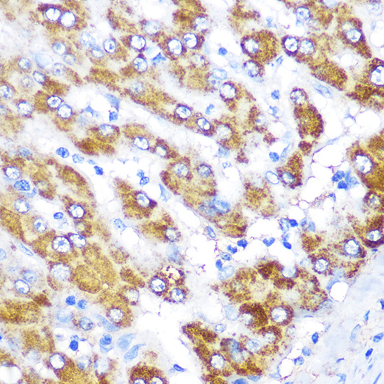 GATM Rabbit polyclonal antibody