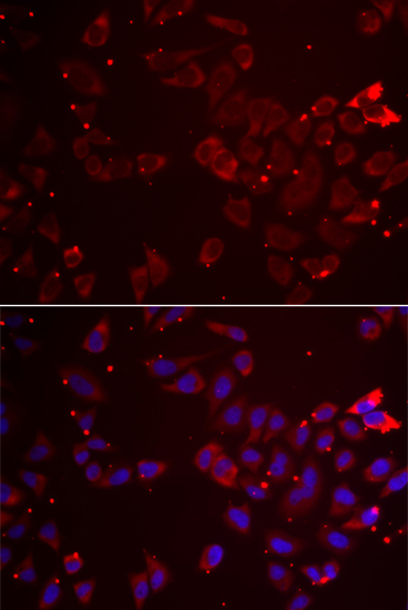 GATM Rabbit polyclonal antibody