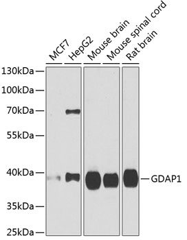 GDAP1 Rabbit polyclonal antibody