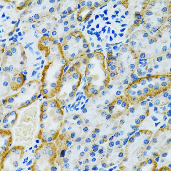 GDAP1 Rabbit polyclonal antibody