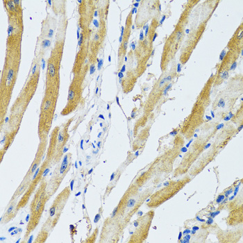 GDAP1 Rabbit polyclonal antibody