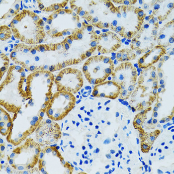 GDAP1 Rabbit polyclonal antibody