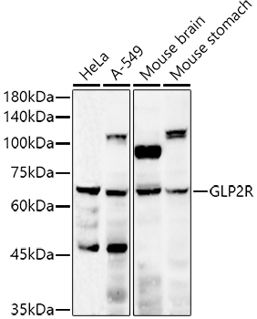 GLP2R Rabbit polyclonal antibody