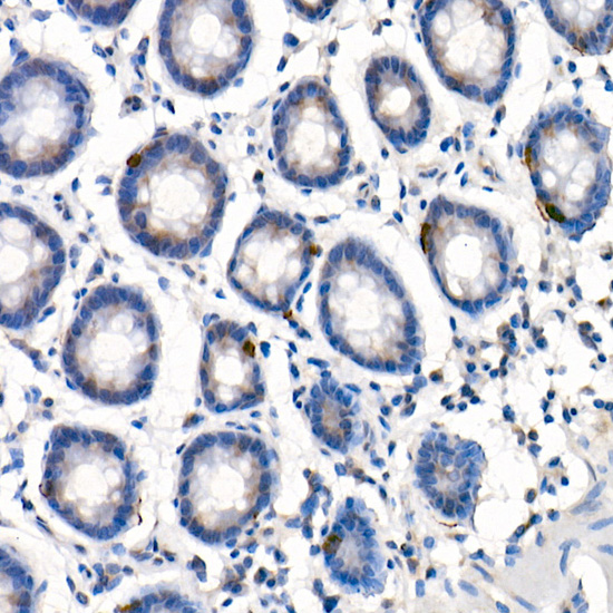 GLP2R Rabbit polyclonal antibody