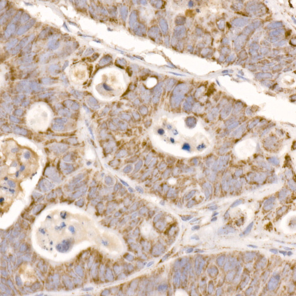 GLUD2 Rabbit polyclonal antibody