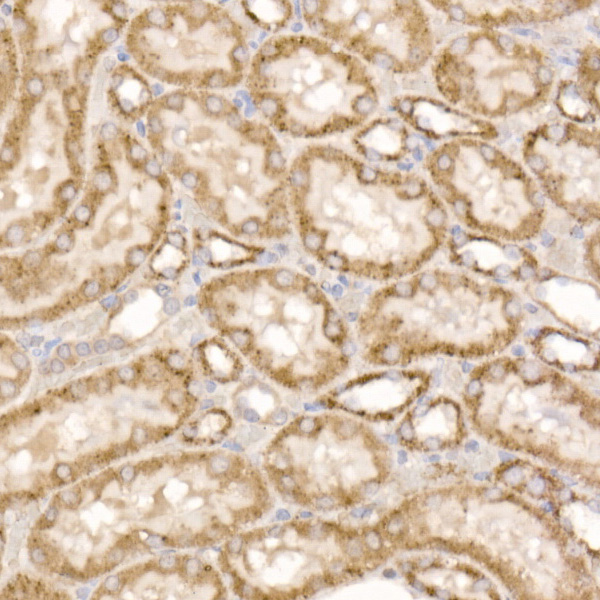 GLUD2 Rabbit polyclonal antibody