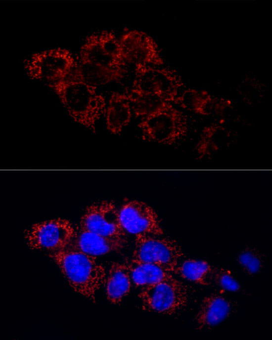 GLUD2 Rabbit polyclonal antibody
