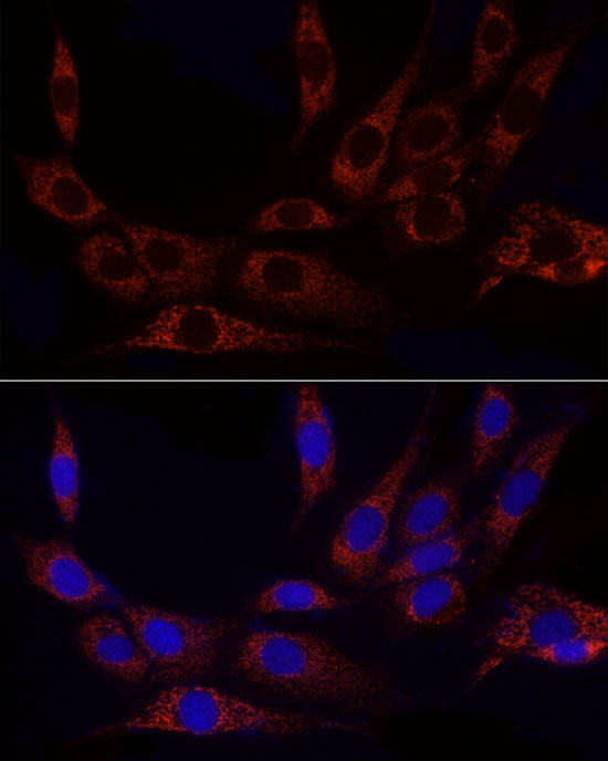 GLUD2 Rabbit polyclonal antibody