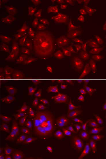 GRASP65 Rabbit polyclonal antibody