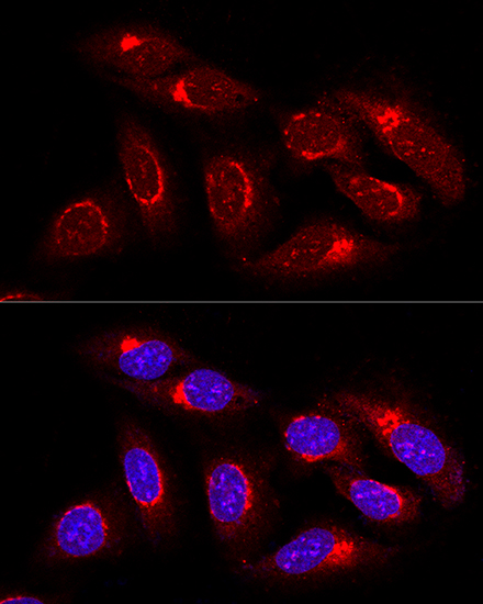 GRASP65 Rabbit polyclonal antibody