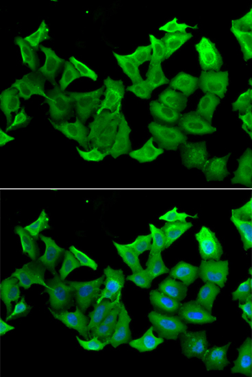 HAGH Rabbit polyclonal antibody