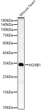 HOXB1 Rabbit polyclonal antibody