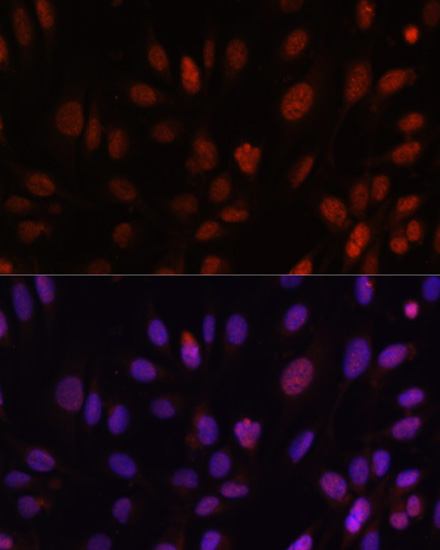 HOXB1 Rabbit polyclonal antibody