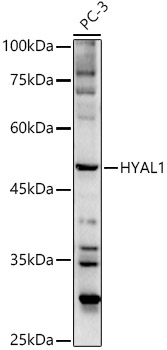 HYAL1 Rabbit polyclonal antibody