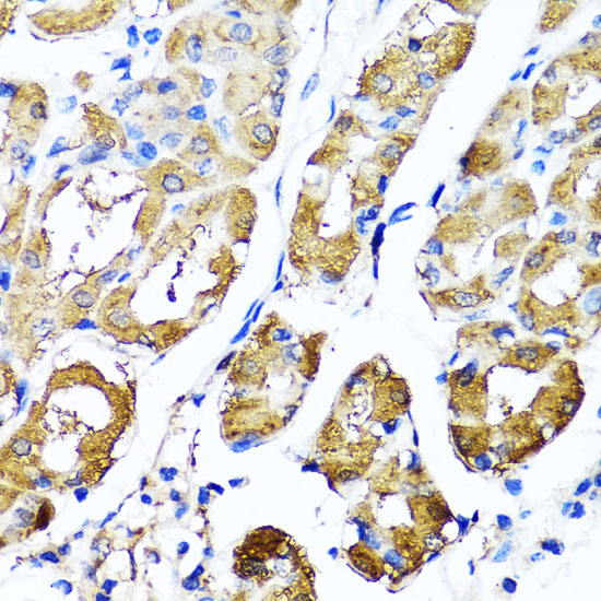 HYAL1 Rabbit polyclonal antibody